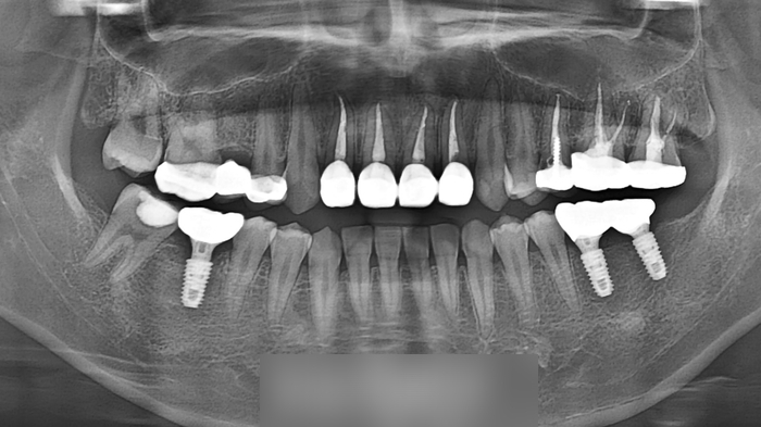Treatment case image 9