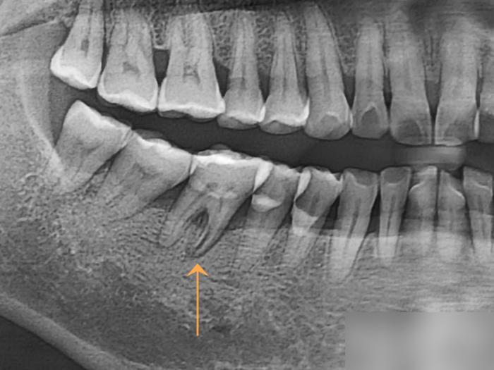 Treatment case image 1