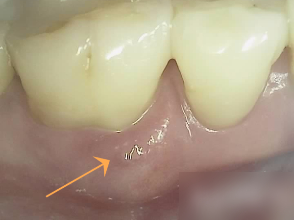 Treatment case image 2