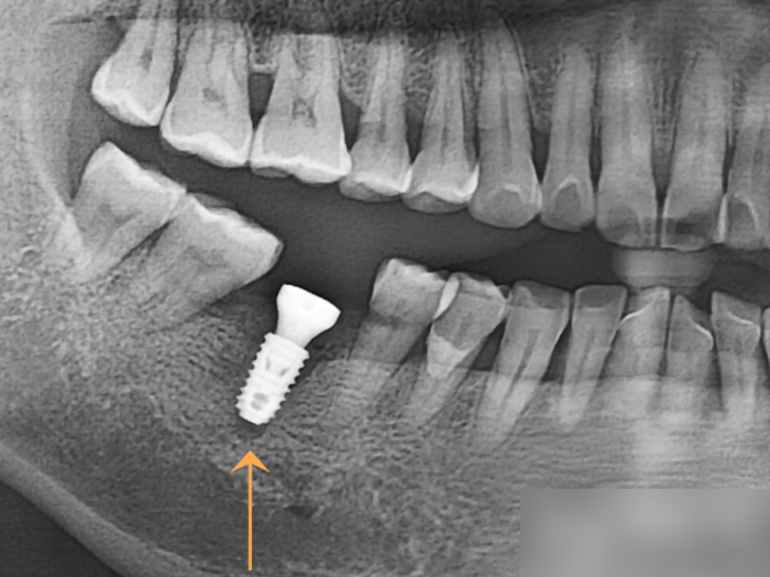 Treatment case image 5