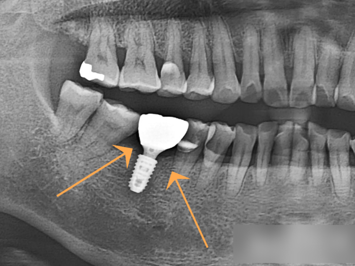 Treatment case image 7