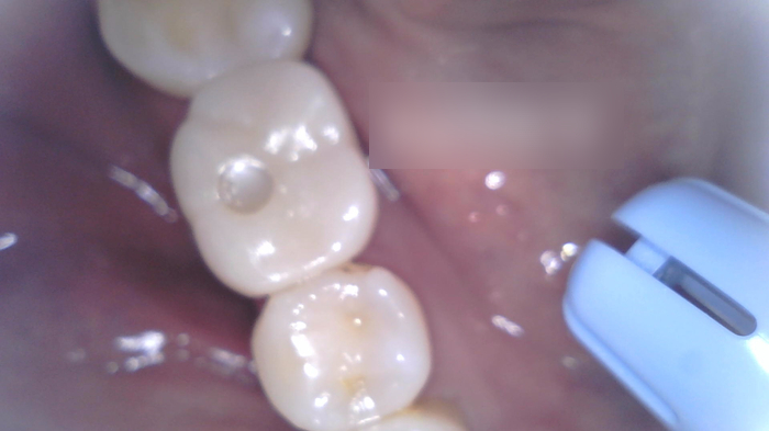 Treatment case image 8