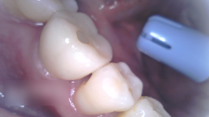 Treatment case image 9