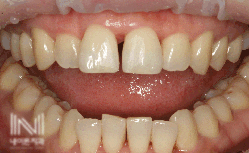 Treatment case image 1