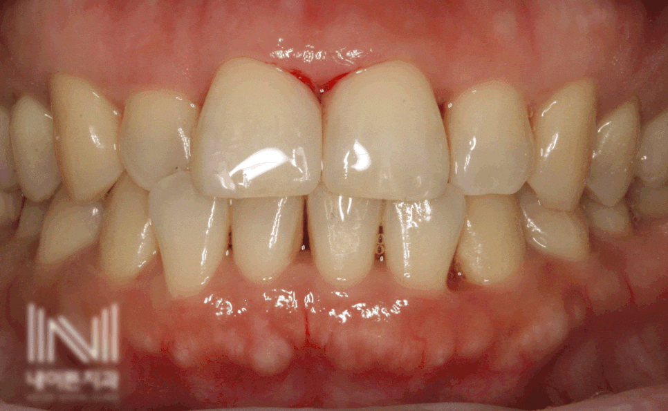 Treatment case image 3