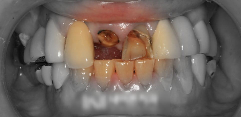 Treatment case image 1