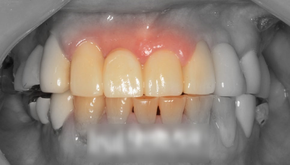 Treatment case image 3