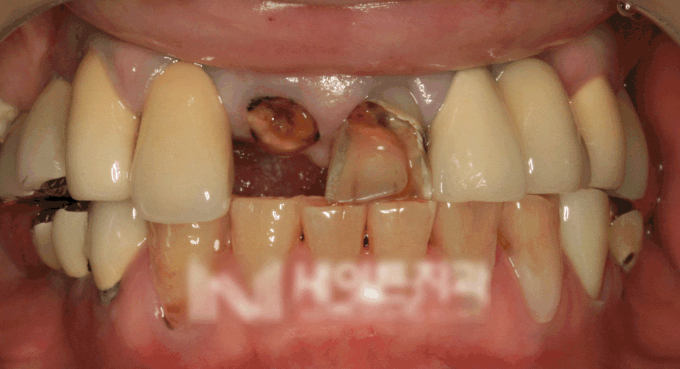 Treatment case image 4