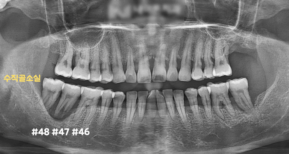 Treatment case image 1