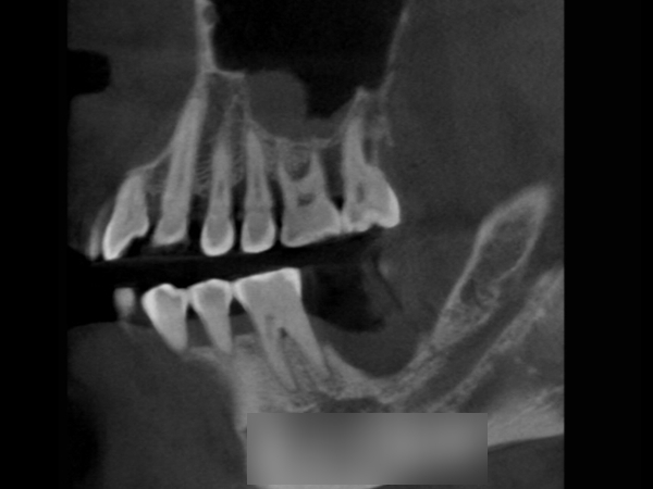 Treatment case image 2