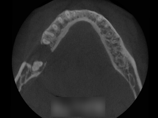 Treatment case image 3
