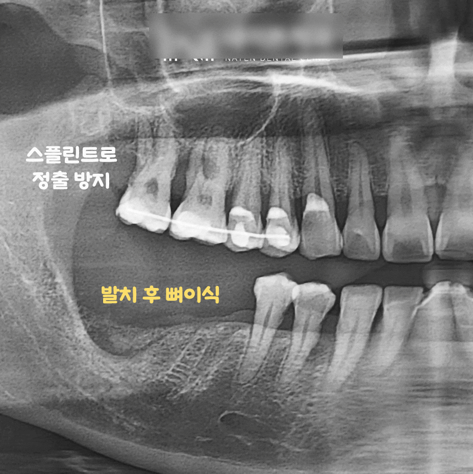 Treatment case image 7