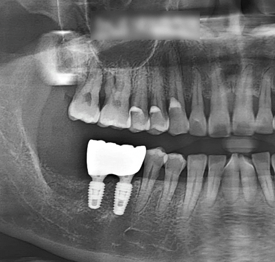 Treatment case image 8