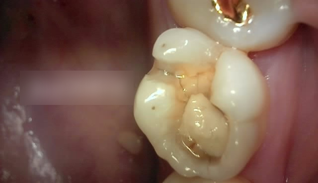 Treatment case image 1