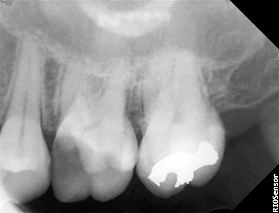 Treatment case image 2