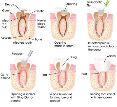 Treatment case image 3