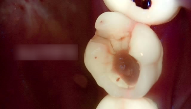 Treatment case image 4