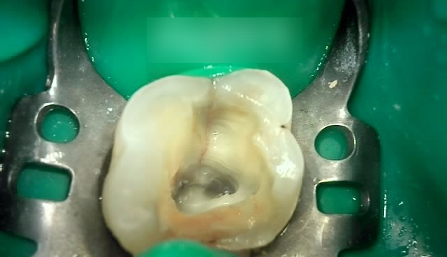 Treatment case image 5