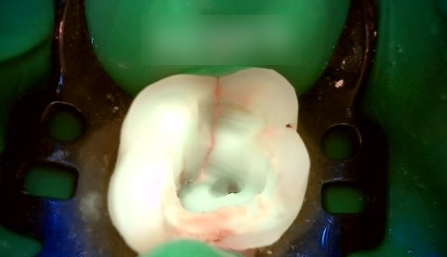 Treatment case image 6