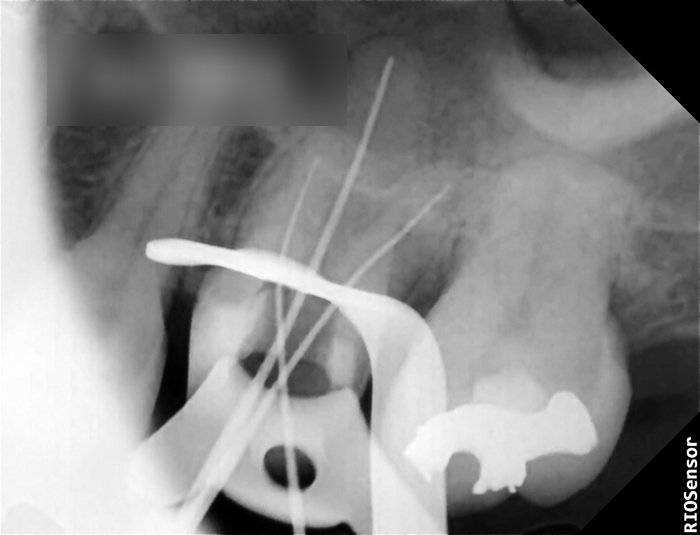 Treatment case image 7