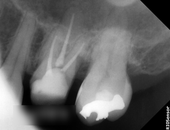 Treatment case image 8