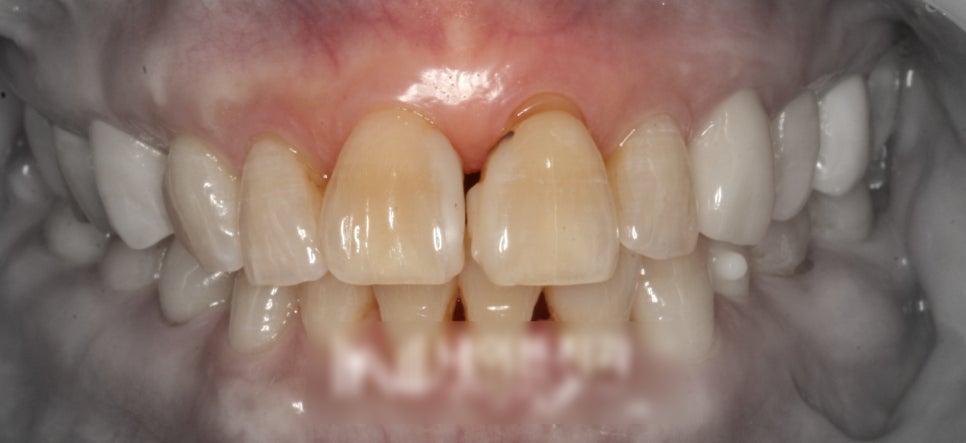 Treatment case image 1