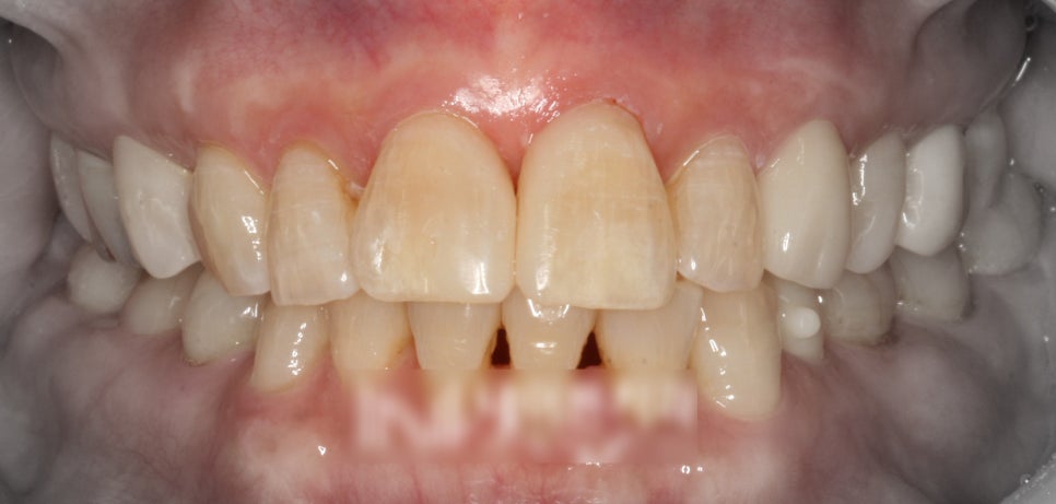 Treatment case image 3