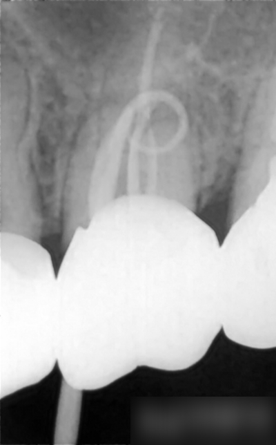Treatment case image 1