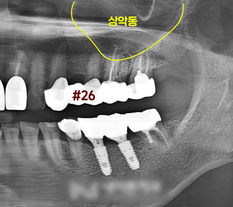 Treatment case image 3