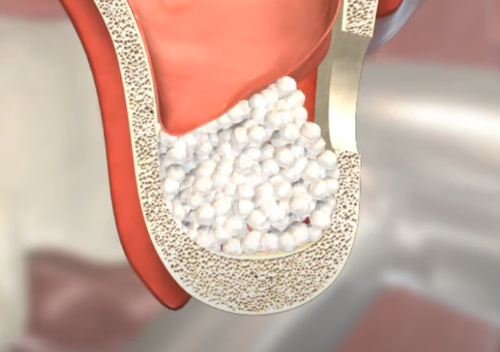 Treatment case image 4