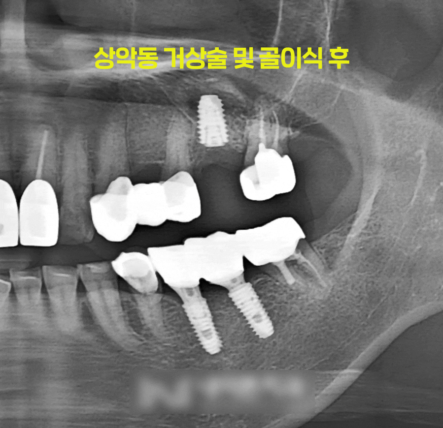 Treatment case image 5