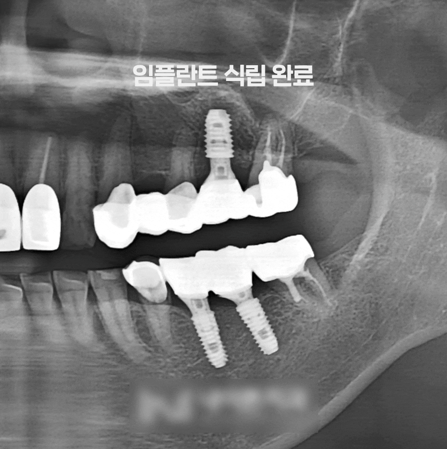 Treatment case image 6