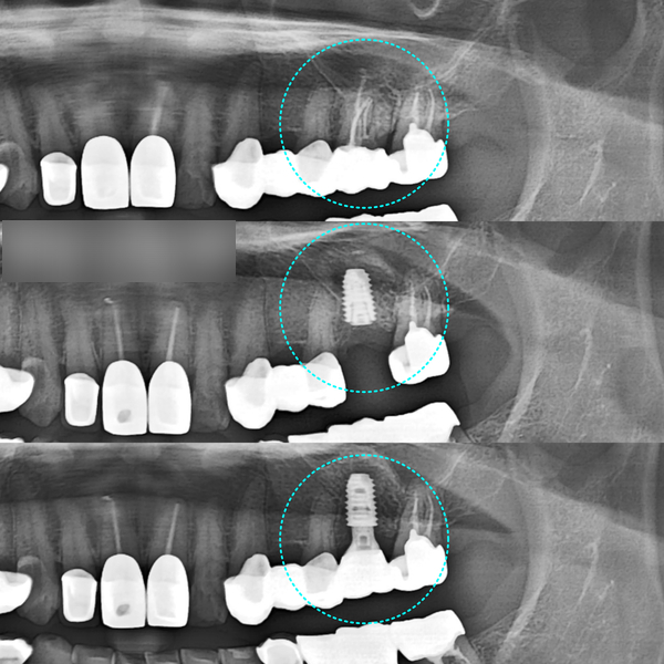 Treatment case image 10