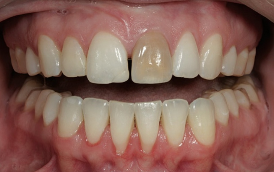 Treatment case image 1