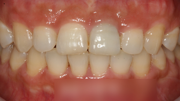 Treatment case image 3