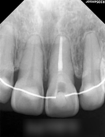 Treatment case image 4