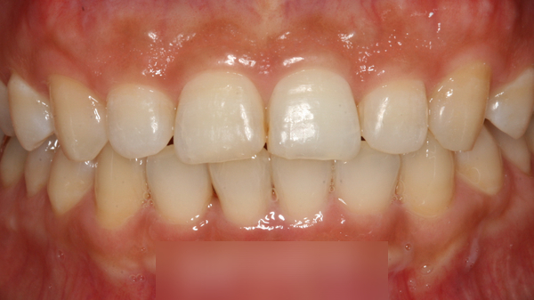 Treatment case image 5