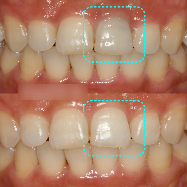 Treatment case image 6