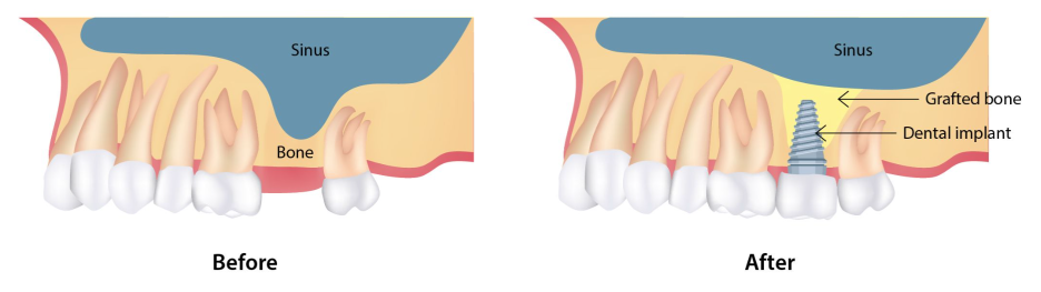 Treatment case image 1