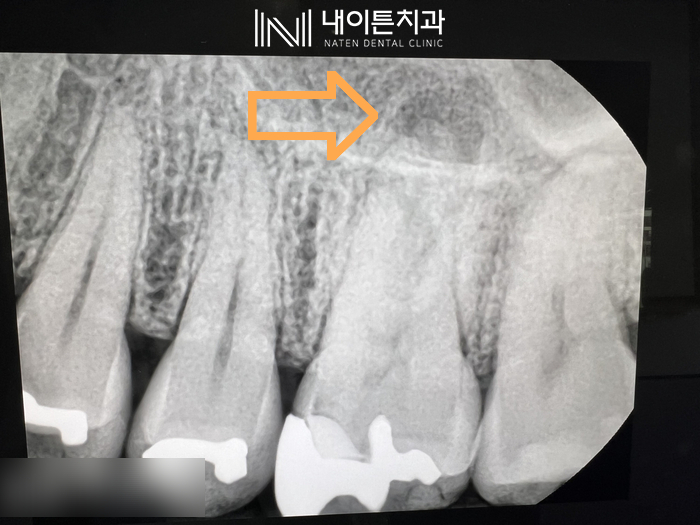 Treatment case image 2