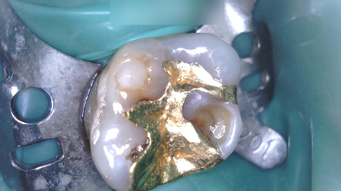 Treatment case image 3