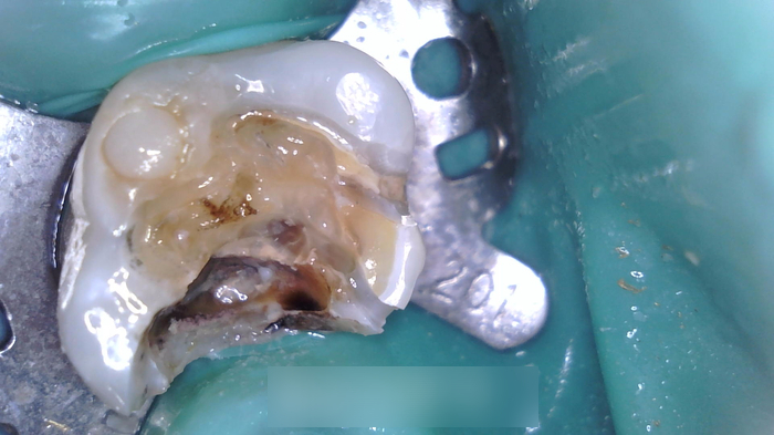Treatment case image 7