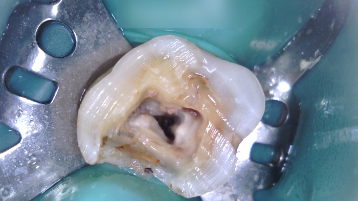 Treatment case image 8