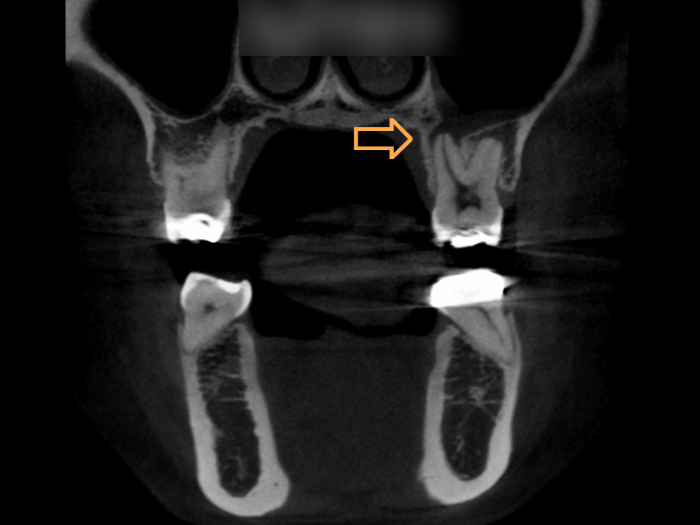 Treatment case image 9