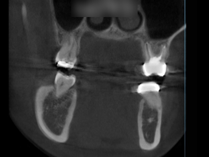 Treatment case image 10