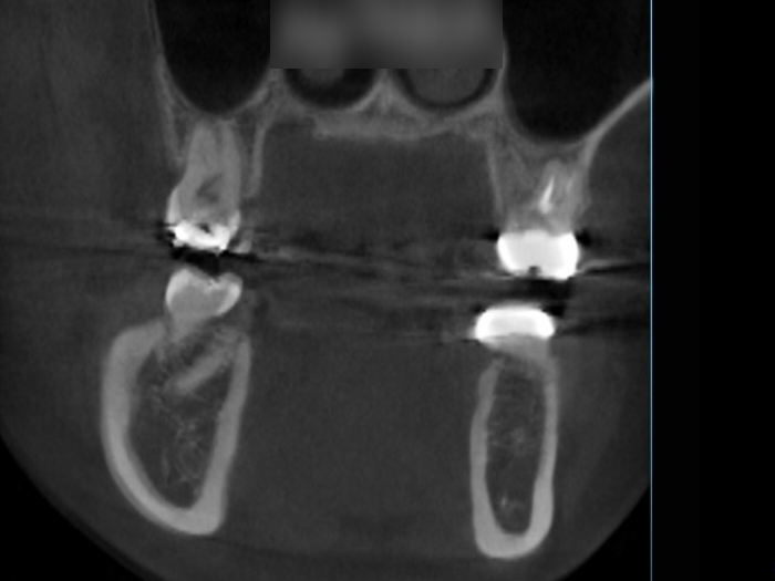 Treatment case image 6