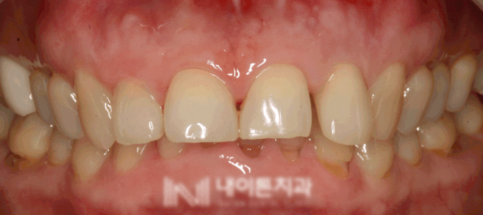 Treatment case image 1