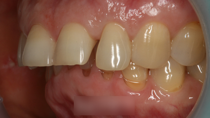 Treatment case image 3