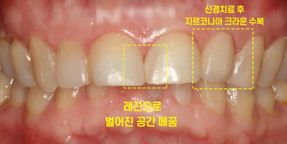Treatment case image 4