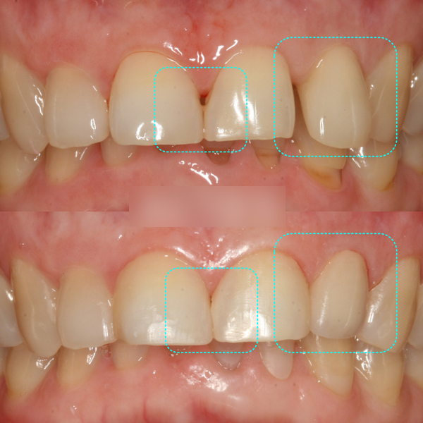 Treatment case image 6